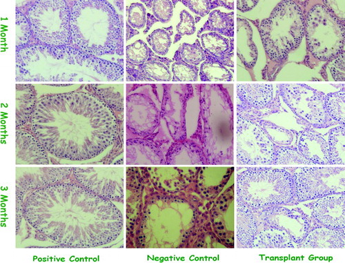 Figure 3.  Manifestations of the positive control, the negative control, and the transplantation group at different checkpoints (H&E Staining ×400). The positive control showed autologous SSCs proliferated at all checkpoints. The negative control showed limited spermatogenesis at all checkpoints. The transplantation group, donor SSCs colonized nearly filled all lumina of the seminiferous tubules at the first checkpoint, and thereafter multiplied dominantly.