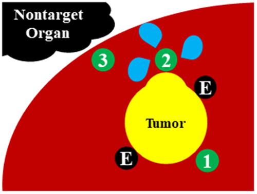 Figure 2. Schematic diagram of the multipurpose needle (MPN) strategy.For the usual cases, the MPN is inserted into the tissue between margin of the tumor and the external margin of ablation zone in order to monitor adequacy of treatment temperature ①. For adjuvant injection (AI), the MPN is inserted into the parenchyma near the tumor margin where the operator plans to create a larger ablation zone ②. For subcapsular parenchyma temperature monitoring (SPTM), the MPN is inserted into the subcapsular parenchyma for continuous temperature monitoring to avoid thermal injury in nontarget organs ③. For all MPN insertions, special care was taken not to directly puncture the tumor for oncological safety purposes.E: electrode.