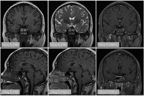 Figure 1 Pituitary magnetic resonance plain scan and enhanced images of patients.
