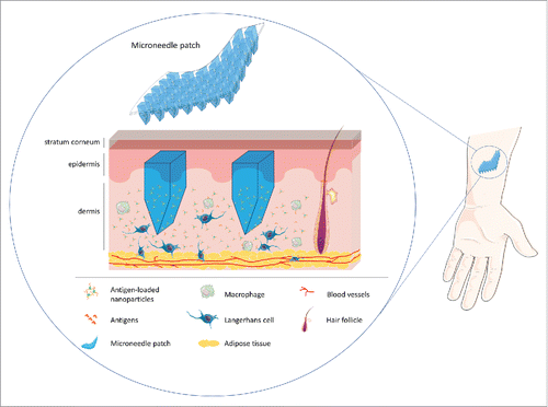 Figure 1. Microneedle patches for the delivery of specific antigens to restore immunotolerance in the context of multiple sclerosis.