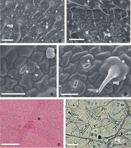 Figure 1  Leaf surface of Verbena native species of Buenos Aires province. A, Adaxial epidermis of V. bonariensis (SEM). B, Abaxial epidermis of V. bonariensis (SEM). C, Anomocytic stomatal apparatus, adaxial epidermis of V. bonariensis (SEM). D, Adaxial epidermis of V. bonariensis (SEM). E, Adaxial epidermis of V. montevidensis (LM). F, Vascularization, abaxial epidermis of V. rigida (LM). Abbreviations: g, glandular trichomes; LM, Light Microscopy; ng, nonglandular trichomes; s, stomata; SEM, scanning electron microscopy. Bars: A, B, F, 200 µm. C, D, E, 50 µm.