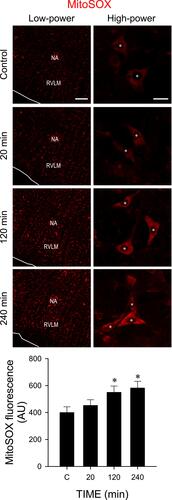 Figure 7 Cadmium induces ROS production in RVLM. Illustrative in situ detection of superoxide in RVLM using a mitochondrial superoxide indicator (MitoSOX) in sham-controls or 20, 120 or 240 min after intravenous administration of cadmium (Cd; 4 mg/kg). Values in quantification of mean intensity of MitoSOX fluorescence are mean ± SEM, n = 3 animals per experimental group. *P < 0.05 vs sham-control (C) group in the Dunnett multiple-range test. White asterisk denotes location of the nucleus in the corresponding RVLM neurons. Scale bar, 200 μm in low-power view or 20 μm in high-power view images.