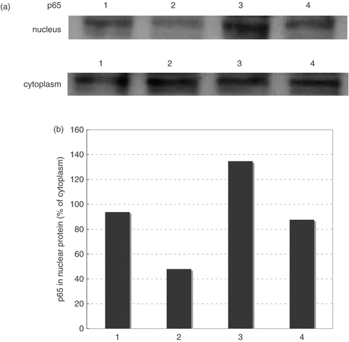 Figure 3. Effects of hyperthermia on TNF-α-induced activation of NF-κB in HAEC. (a) The status of NF-κB activation was evaluated by Western blotting of p65 in nuclear protein. Upper band shows the Western blotting of nuclear p65 and lower band shows the Western blotting of cytoplasmic P65. (b) Quantification of each band was performed by densitometry analysis software (image J), and results were expressed as the ratio (cytoplasm) in arbitrary units. Lane 1; control, Lane 2; hyperthermia alone, Lane 3; TNF-α alone, Lane 4; hyperthermia pretreatment with TNF-α.