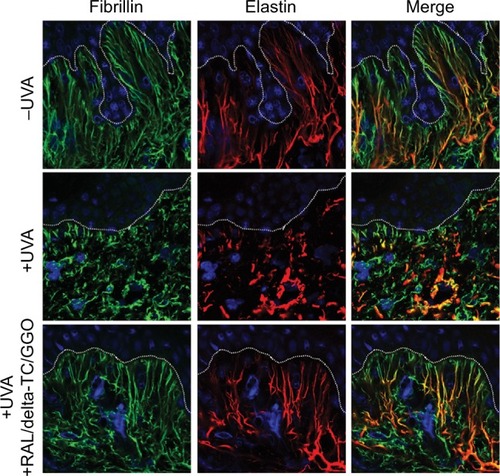 Figure 4 Not irradiated (−UVA), UVA-irradiated (+UVA) and UVA-irradiated human skin explants treated with a dermocosmetic formulation containing a combination of RAL/delta-TC/GGO assessed by using immunohistochemistry and confocal microscopy.