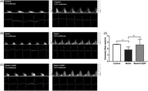 Figure 2. Pre-treatment with CDDP improved coronary flow reserve. Data are mean ± SD from 10 mice. *p < 0.05, model vs. control group. #p < 0.05, model vs. model + CDDP group.