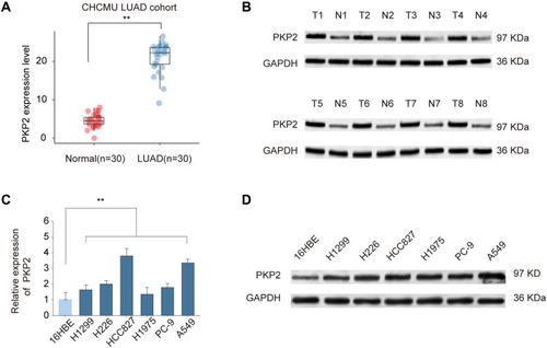 Figure 1 PKP2 expression is upregulated in LUAD. (A) The relative PKP2 mRNA expression levels of PKP2 in LUAD tissues and adjacent normal tissues were analyzed by qPCR. (B) The protein expression of PKP2 in 8-paired LUAD and normal control tissues were analyzed by Western blot. (C and D) The mRNA expression (C) and protein expression (D) of PKP2 in lung cancer cell lines (H1299, H226, HCC827, H1975, PC-9 and A549) and human bronchial epithelial control (16HBE) were analyzed by qPCR and Western blot. **P < 0.01.