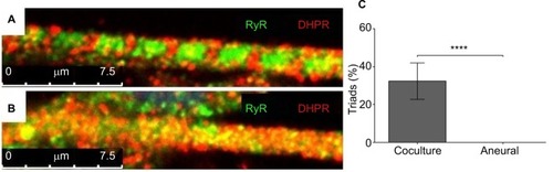 Figure 4 Characterization of myotubes at day 14.