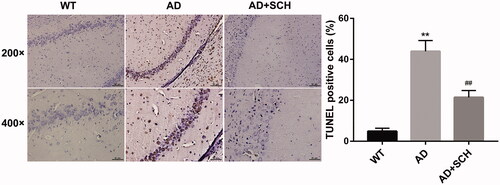 Figure 2. Schizandrin inhibited cell apoptosis in brain tissues of Alzheimer’s disease mice. APP/PS1 mice received Sch A or distilled water administration. C57BL/6 WT mice served as control. TUNEL assay was performed to assess cell apoptosis in brain tissues of mice. **p < 0.01 vs. WT; ##p < 0.01 vs. AD.