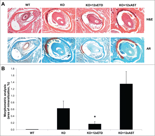 Figure 1. Demonstration that ETD prevents ectopic mineralization in Abcc6−/− knock-out (KO) mice. (A) The Abcc6−/− mice develop ectopic mineralization of the dermal sheath of vibrissae when examined at 12 weeks of age by histopathology with Hematoxylin and Eosin (H&E, upper panel) and Alizarin Red (AR, lower panel) stains. Note that the corresponding wild-type (WT) mice have no evidence of mineralization. Feeding the mice with diet supplemented with 12xETD markedly reduced the mineral content of the dermal sheath of vibrissae, while there was no change in mice fed with 12xAST containing diet. (B) The degree of mineralization was quantitated by computerized morphometric analysis of the histopathologic sections, confirming the reduction in mice fed with 12xETD containing diet in comparison to KO mice (mean ± SE; n = 8–11; *, P < 0.05).