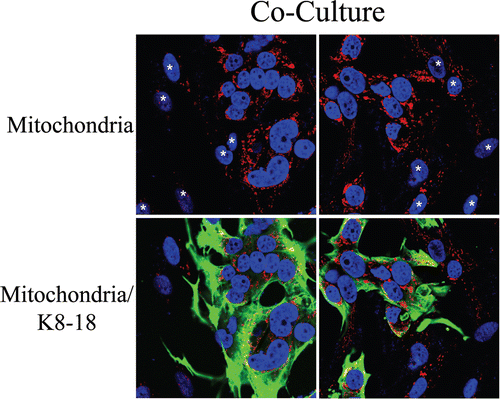Figure 10 Fibroblasts induce increased mitochondrial mass in co-cultured MCF7 cells: Double-labeling with keratin shows co-segregation with mitochondrial mass. Mitochondrial mass is low in fibroblasts and elevated in MCF7 cells in co-culture. Co-cultures of hTERT-fibroblasts and MCF7 cells were fixed and immunostained with anti-intact inner mitochondrial membrane (red) and anti-K8/18 (green) antibodies. DAPI was used to stain nuclei (blue). Note that in co-culture the mitochondrial mass is low in fibroblasts but elevated in MCF7 cells. Stars denote fibroblast nuclei. Importantly, images were acquired using identical exposure settings used in Figure 9. original magnification, 63x.