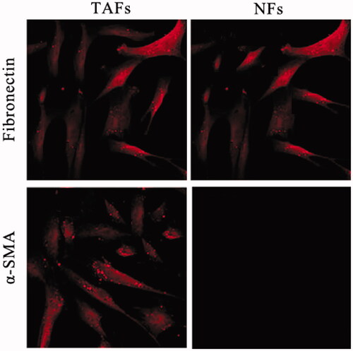 Figure 1. Characterization of tumour-associated fibroblasts (TAFs) and normal fibroblasts (NFs). The primary cultures of TAFs and NFs were isolated from the tumour tissue and the adjacent normal gastric mucosa. Fibronectin (FN), the fibroblast biomarker, is universally expression in TAFs and NFs. α-smooth muscle actin (α-SMA), the biomarker of the activate fibroblast is a high level expression in TAFs and weak expression in NF.