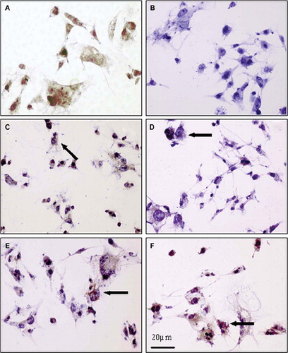 Figure 8. Immunocytochemistry images of stained SKMEL-30 cell with c-myc antibody. (A) Nucleus of cell (stained with c-myc antibody), where brown spots indicate c-myc positive cells as a control (non-treated with polymer/ASODN complex). (B) Cells transfected with PCL-mPEG5000/PEI at N/P: 9; blue spots show c-myc negative cells. (C) Cells transfected with PCL-mPEG2000/PEI at N/P: 9; arrow shows c-myc positive cells and some of cells nuclei blue as c-myc negative cell. (D) Cells transfected with PLL-mPEG2000/PEI at N/P: 3; arrow shows c-myc-positive cell. (E) Cells transfected with PCL-mPEG5000/PEI at N/P: 1; arrow showss c-myc positive cell. (F) Cells transfected with PLL-mPEG5000/PEI at N/P: 3; arrow shows c-myc positive cell. Images were recorded with ×400 magnification and with an Olympus research microscopy.