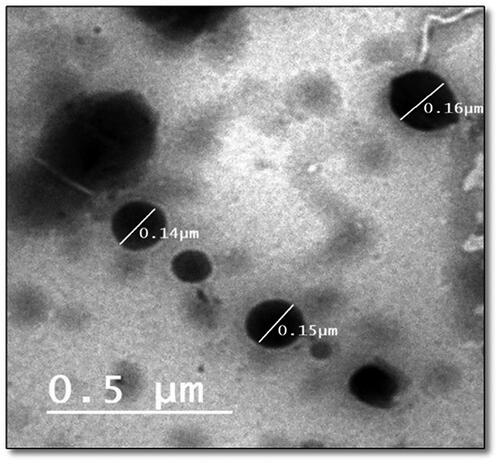 Figure 5. Transmission electron micrograph of the optimized LORA-NLCs-2.