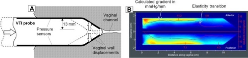 Figure 4 (A) VTI probe insertion to deform vaginal walls in a definitive manner and (B) a tactile image for VTI probe insertion into a silicone model with known elasticity distribution.