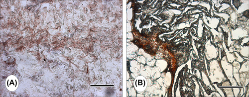 Figure 5. Anti-osteopontin staining of MC3T3-E1 cell-laden CS/HA scaffold after 21 days of culture. Scale bars: 300 μm (A), 150 μm (B).
