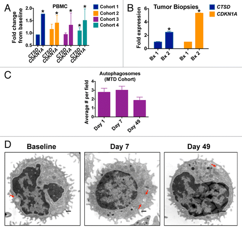 Figure 3. HCQ and VOR stimulate the expression of CTSD and CDKN1A and the accumulation of autophagic vacuoles. (A) Fold change from baseline in the levels of CTSD and CDKN1A in PBMC specimens in individual cohorts. PBMC specimens were collected at baseline and on C1D7. Gene expression was quantified by qRT-PCR and normalized to GAPDH. *Indicates a significant change from baseline, P < 0.05. (B) Tumor biopsies were obtained from 2 patients with colorectal cancer at baseline and on d 49 (Patient #1 = unmutated RAS, Patient #2 = mutant KRAS). The fold change from baseline in the levels of CTSD and CDKN1A expression in tumor specimens was quantified by qRT-PCR and normalized to GAPDH. *Indicates a significant change from baseline, P < 0.05. (C and D) Effects of treatment on autophagic vacuoles. PBMC specimens were collected from patients at baseline and post-treatment on d 7 and 49. Transmission electron microscopy was utilized to visualize and quantify autophagic vacuoles in PBMCs. The average number of autophagic vacuoles per cell for patients enrolled in the MTD cohort (cohort 3) is shown in (C). Representative images for one patient’s specimens collected at baseline, d 7 and d 49 are shown in (D).