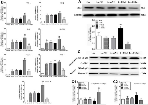 Figure 6 Effects of Ufm1 on the levels of inflammatory mediators and NF-κB p65 nuclear translocation in the RPMs of db/db mice. (A). Levels of Ufm1 in RPMs from each group; (B). mRNA expression of pro-inﬂammatory cytokines (TNF-α, IL-1β, and IL-6), chemokines (MCP-1 and CXCL2) and adhesion molecules (ICAM-1 and VCAM-1) were quantiﬁed by using qRT-PCR. For each gene, the mean level was divided by the respective mean of the wild-type; (C). Immunoblotting results showing cytoplasmic and nuclear NF-κB p65 expression in RPMs of the con, Lv-shUfm1, Lv-shNC, Lv-Ufm1 and Lv-NC groups. The expression of cytoplasmic (C1) and nuclear (C2) p65 was quantified and is shown as the fold change compared to the internal control (histone). The data are represented as the mean±SD, n=6. **P<0.01 compared to the control (wild type) group; #P<0.05, ##P<0.01 compared to the Lv-NC group; ΔΔP<0.01 compared to the Lv-shNC group.