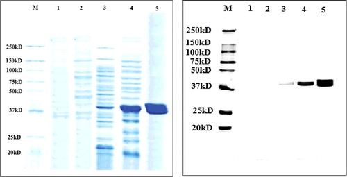 Figure 8. SDS-PAGE (A) and Western blotting (B) analyses showing the purification of recombinant lipase KV1 expressed in E. coli BL21 (DE3). (A) Proteins recovered during the various purification steps were analysed by SDS-PAGE. Lane M: prestained standard protein molecular weight markers; Lane 1: lysate supernatants of uninduced transformant harbouring empty pET-30a(+); Lane 2: lysate supernatants of induced transformant harbouring empty pET-30a(+); Lane 3: uninduced intracellular lysate supernatants pET-lipKV1; Lane 4: induced intracellular lysate supernatants pET-LipKV1 and Lane 5: purified fraction from Ni–NTA column eluted by buffers containing 200 mmol/L imidazole. (B) Western blot analysis of purification steps probed with an anti-His antibody. The samples are the same as those described for panel (A).