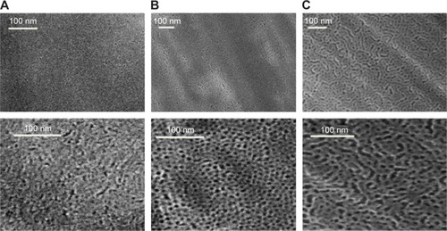 Figure 2 SEM micrographs of mesoporous titania synthesized with different templates presented at two different magnifications.Notes: (A) CTAB, (B) P123, and (C) P123 + PPG (1:1).Abbreviations: SEM, scanning electron microscopy; CTAB, cetyltrimethylammonium bromide; P123, Pluronic® P123; PPG, polypropylene glycol.