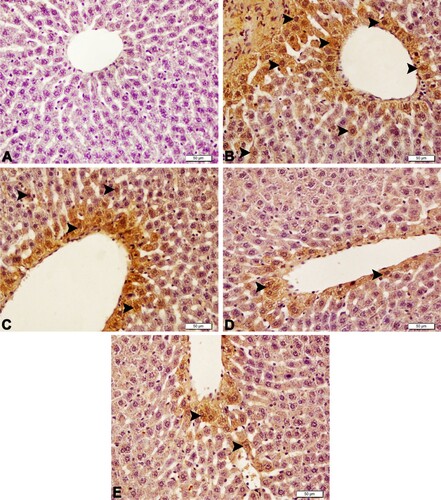 Figure 5. Caspase-3 expression of liver sections. A (Sham group): Negative expression of cytoplasmic caspase-3, B (Sepsis group): Severe expression of cytoplasmic caspase-3 in hepatocytes (arrowheads), C (OSJ 150 group): Moderate expression of cytoplasmic caspase-3 in hepatocytes (arrowheads), D (OSJ 300 group): Mild caspase-3 expression (arrowheads), E (REFgroup): Mild caspase-3 expression in hepatocytes (arrowheads), IHC-P, Bar: 20 µm.