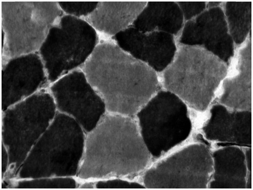 Figure 1. Sample of myofibers from the soleus muscle of Wistar rats histochemically stained for myosin ATPase following acidic preincubation at pH 4.6. Darker myofibers are type I and lighter type II. Original magnification of 400×.