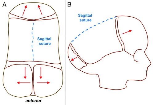 Figure 2. Sagittal synostosis (Scaphocepaly). Top view (A) and lateral view (B) schematics showing the direction of aberrant compensatory bone growth (red lines) following premature sagittal suture fusion leading to an elongated, scaphocephalic skull, derived from the Greek word scaphos for boat and cephalos for head.