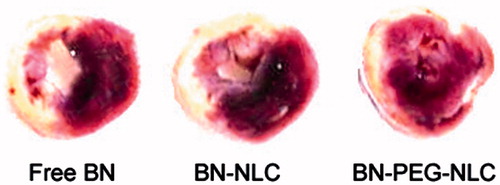Figure 5. The images of BN solution, BN-NLC, and BN-PEG-NLC on infract size. BN: baicalin; PEG: polyethylene glycol; NLC: nanostructured lipid carriers.