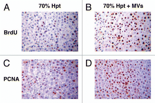 Figure 3 Proliferative effect of HLSC-derived MVs in experimental 70% hepatectomy. Effect of MVs on liver cell proliferation evaluated as BrdU (A and B) and as PCNA (C and D) incorporation in 70% hepatectomized rats. (A and B) Representative micrographs of BrdU uptake performed on sections of liver 24 hrs after 70% hepatectomy in rats treated with vehicle (A) or treated with 30 g MVs (B). BrdU was injected intraperitoneally 2 hrs before rats were killed. Original magnification: x200. (C and D) Representative micrographs of PCNA staining performed on sections of liver 24 hrs after 70% hepatectomy in rats treated with vehicle (C) or treated with 30 g MVs (D). Original magnification: x200. (Described in ref. Citation54).
