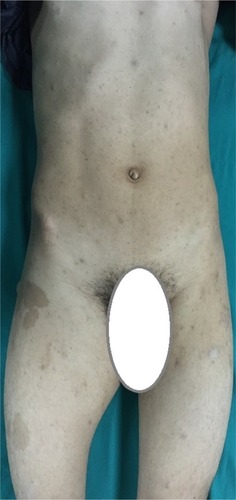 Figure 1 External appearance of a 15-year-old boy.