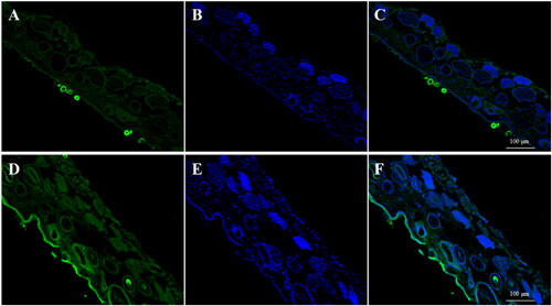 Figure 6. Laser confocal microscopy of percutaneous skin penetration with sodium fluorescein (Blank (A) Fluorescein sodium; (B) DAPI; (C) Fluorescein sodium + DAPI; MNs (D) Fluorescein sodium; (E) DAPI; (F) Fluorescein sodium + DAPI).