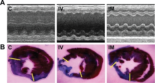 Figure 3 Measurements of cardiac function and infarct size. A) Representative M-mode images at the level of papillary muscles were recorded among three groups. B) Representative Masson’s trichrome-stained histological sections to measure infarct size. Collagen presented blue but myocardium appeared red. Infarct size was quantified as the area occupied by collagen (blue; yellow hash marks).Abbreviations: C, control group; IV, intravenous group; IM, intramyocardial group.