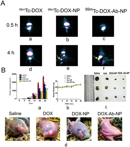 Figure 10 Biodistribution of drug/formulation data and, tumor and tumor-related data in experimental animals.Notes: (A) Biodistribution and accumulation data of 99mTc labeled drug/formulations in experimental mice (a) time-dependent biodistribution and accumulation of 99mTc-DOX at 0.5 hrs (d) and at 4 hrs, (b) 99mTc -DOX-NP at 0.5 hrs (e) and 4 hrs, and (c) 99mTc -DOX-Ab-NP at 0.5 hrs and (f) 4 hrs, in xenograft mice-bearing breast tumor. (B) Changes in tumor volume, animal body weight, and excised tumors from the experimental mice along with the tumor growth-related representative visual image data. (a) Relative changes in tumor volume with time. Data showed mean tumor volume (mean ± SD, n=3) in different experimental and control mice. The value p<0.05 shows the level of statistical significance. Prefix of p (i.e., a–j), indicates as mentioned below: “a” indicates statistical level of significance when data were compared against normal saline treated (control) mice on day 10; “b” indicates statistical level of significance when data were compared against DOX-treated mice on day 10; “c” indicates statistical level of significance when data were compared against normal saline treated (control) mice on day 15; “d” indicates statistical level of significance when data were compared against DOX-treated mice on day 15; “e” indicates statistical level of significance when data were compared against normal saline treated (control) mice on day 20; “f” indicates statistical level of significance when data were compared against DOX-treated mice on day 20; “g” indicates statistical level of significance when data were compared against DOX-NP-treated mice on day 20; “h” indicates statistical level of significance when data were compared against normal saline treated (control) mice on day 25; “i” indicates statistical level of significance when data were compared against DOX-treated mice on day 25; “j” indicates statistical level of significance when data were compared against DOX-NP-treated mice on day 25. (b) Change of body weight of nude mice-bearing tumor. Data represent mean ± SD (n=3); data showed that there was no statistically significant variation between the groups of mice. (c) Tumors excised from the experimental mice after treatment with saline/DOX/DOX-NP/DOX-Ab-NP. (d) Images on day 25 of nude mice bearing SKBR-3 tumor after treatment with saline/DOX/DOX-NP/DOX-Ab-NP. Tumor areas have been marked with red circles in the figure.Abbreviations: 99mTc-DOX: radiolabeled free-doxorubicin, 99mTc-DOX -NP: radiolabeled doxorubicin loaded nanoparticles, 99mTc-DOX-Ab-NP: radiolabeled doxorubicin loaded antibody conjugated nanoparticles; DOX, doxorubicin; Ab, antibody; NP, nanoparticle.