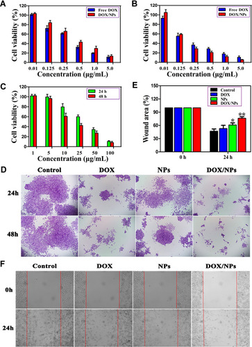 Figure 2 Effect of free DOX, NPs and DOX/NPs on cell viability and migration. (A) for 24 and (B) 48 h. (C) Cytotoxicity of NPs on B16F10 cells for 24 and 48 h. (D) Colony formation after drugs treatment via crystal violet staining. (E) Quantification of wound area in free DOX, NPs and DOX/NPs treated B16F10 cells. (F) Wound healing assay in B16F10 cells treated with free DOX, NPs or DOX/NPs for 24 h (magnification ×100). The data represent mean ±SD. n=3–4. *p<0.05 vs control, **p<0.05 vs DOX or NPs.