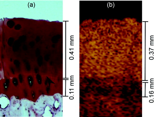 Figure 5. Non-calcified articular cartilage thickness was measured as the distance between the cartilage surface and the tidemark (arrowhead), seen here by light microscopy (panel a) and OCT (panel b). The full cartilage thickness also included the thickness of calcified cartilage. Calcified cartilage can be seen in OCT images as a low-scattering layer.