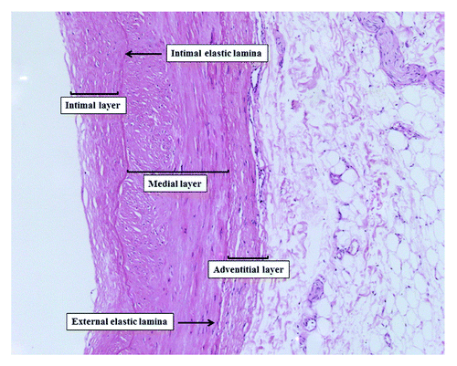 Figure 3. Blood vessels microanatomy (hematoxilin-eosin staining 430×).