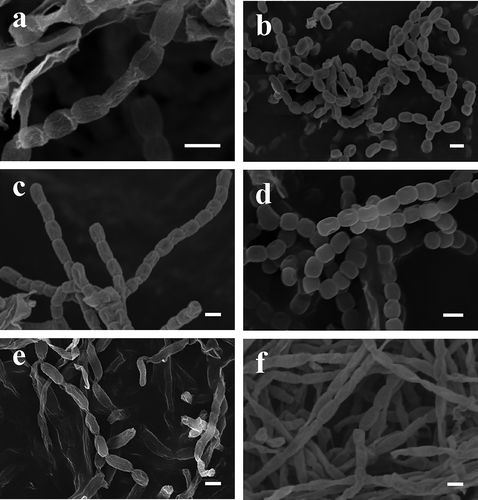 Fig. 2. Spore chain morphology of (a) Streptomyces griseus Lac1, (b) Streptomyces rochei Lac3, (c) Streptomyces anulatus Pru14, (d) Streptomyces champavatii Pru16, (e) Nocardiopsis dassonvillei subsp. dassonvillei Vic8 and (f) Nocardiopsis alba Pin10 observed with scanning electron microscopy. Bars represent 1 μm.