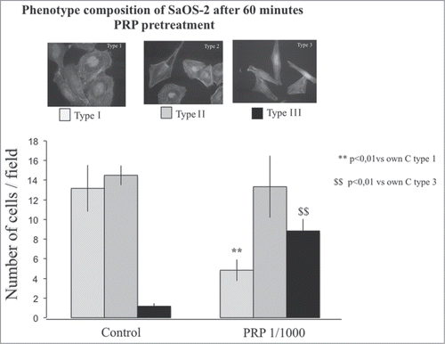 Figure 6. Phenotype composition of SaOS-2 cells after a 1 hour PRP treatment. Fluorescence images of the 3 types of SaOS-2 cells (Type I, Type II, and Type III) counted in control and PRP treated (for 1 hour) coltures. The number of cells is the mean of 6 fields for each treatment. Images in fluorescence microscopy at 10× magnification.