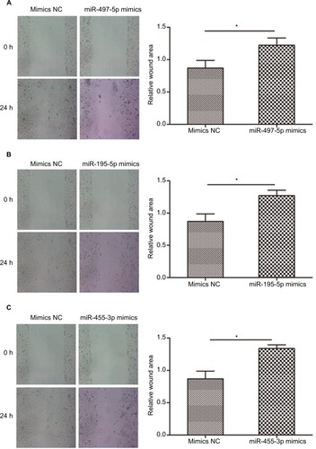 Figure 6 Overexpression of miR-497-5p, miR-195-5p and miR-455-3p inhibited cell migration and invasion abilities.Notes: (A–C) Micrographs of 0 and 24 h (left, 100×) and quantification data of relative wound area (right, 24 h) were analyzed by Image J software. (D–F) Quantification data of invasion cells (left) and micrographs of crystal violet-stained cells (right, 200×) are shown. All data are presented as mean±SD, and all of these experiments were performed in triplicate. ***p<0.001; *p<0.05, compared to control groups.Abbreviation: NC, negative control.