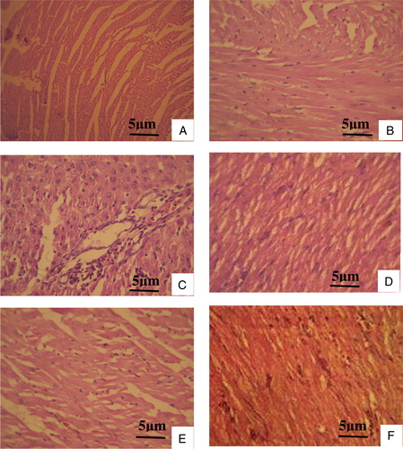Figure 3. Histopathological changes of cardiac muscle (hematoxylin and eosin stain). (A) Normal cardiac muscle bundles. (B) VA-treated control rat heart showing normal muscle fibers without any pathological changes. (C) l-NAME-treated rat heart showing splitting of cardiac muscle fibers and inflammatory cells. (D) l-NAME with 25 mg VA treatment reduced the rupture of muscle fibers, and mononuclear infiltration. (E) l-NAME with 50 mg VA treated rat heart showing muscle fibers with mild hyalinization. (F) l-NAME with 100 mg VA focal collection of mononuclear cells and fibrosis.