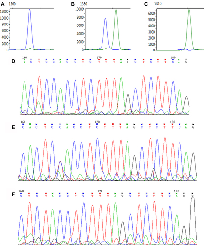 Figure 1 Results of SNaPshot microsequencing and DNA sequencing of MMP-2. (A–C) Results of SNaPshot microsequencing of MMP-2. (A) The results of SNaPshot microsequencing of CC genotype. (B) The results of SNaPshot microsequencing of CT genotype. (C) The results of DNA sequencing of TT genotypes. (D–F) Results of DNA sequencing of MMP-2. (D) The DNA sequencing of the CC genotype of MMP-2. (E) The DNA sequencing of the CT genotype of MMP-2. (F) The DNA sequencing of the TT genotype of MMP-2.