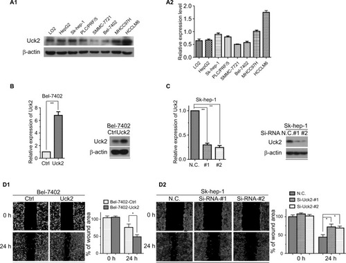 Figure 3 Uck2 promoted HCC cell migration and invasion in vitro.Notes: (A1 and A2) Raw photos and densitometry analysis of Western blotting: endogenous Uck2 expression in one normal liver cell line and seven human HCC cell lines. β-actin was used as the housekeeping gene to normalize expression levels in the densitometry analysis by ImageJ software(1.48 version; NIH, Bethesda, MD, USA). (B) Stable Uck2 overexpression in Bel-7402 cells infected with the ectopic expression vector, as detected by RT-qPCR and Western blotting. (C) A specific Uck2 siRNA resulted in the reduction of Uck2 expression in Sk-hep-1 cells, as detected by RT-qPCR and Western blotting. (D1 and D2) Effects of Uck2 overexpression and knockdown on HCC cell migration by a wound-healing assay. The experiments were repeated three times, and the results are shown as the mean ± SD; *P<0.05; **P<0.01, which indicates a significant difference by an independent Student’s t-test.Abbreviations: Ctrl, control; CV, coefficient of variation; HCC, hepatocellular carcinoma; N.C., negative control; Si, Si-RNA; Uck2, uridine-cytidine kinase 2.