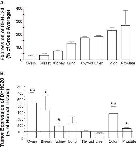 Figure 5.  Expression of DHHC20 in normal human tissue and tumors. Lyophilized β-actin-normalized cDNA obtained in a 96-well format from Origene Technologies was amplified using a DHHC20-specific primer/probe. (A) Comparative expression of DHHC20 in normal tissue samples. The average Ct value for each tissue group was determined, and the % relative expression was calculated using the equation: % relative expression = (2-ΔCt) × 100, where ΔCt represents the difference in Ct for the tissue group vs. the average Ct for all tissue types. (B) Expression of DHHC20 in tumor vs. matched normal tissue. The average Ct value for each normal tissue and tumor-derived group was determined, and the % relative expression was calculated using the equation: % relative expression = (2 -ΔCt) × 100, where ΔCt represents the difference in Ct for the tumor-derived samples from the Ct for the normal tissue samples. Values represent the mean ± SEM of four experiments. For Panel B, (*) indicates p ≤ 0.05 and (**) indicates p ≤ 0.01.