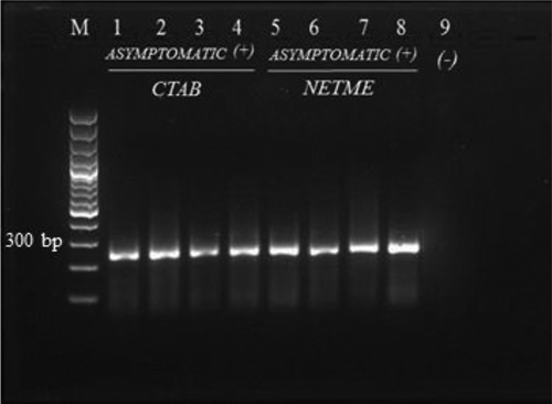 Fig. 3 RT-PCR product from asymptomatic samples extracted using the CTAB extraction and NETME methods. Lane M: 100 bp ladder; Lanes 1–3: asymptomatic samples extracted using CTAB; Lane 4: SB 346 extracted using CTAB; Lane 5–7: asymptomatic sample extracted using NETME; Lane 8: SB 346 extracted using NETME; Lane 9: negative control (no template).
