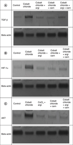 Figure 2. (A–C) Representative immunoblots (Western blot analysis) of hepatic TGF-β, HIF1-α, and AKT in control and different treated groups.