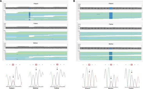 Figure 1 Example of pathogenic mutations identified in the cohort.