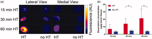 Figure 4. Tumor drug uptake increases with duration of HT. (a) At the conclusion of HT, the entire tumors were excised and fluorescence imaging was performed for both lateral and medial views. Higher fluorescence in lateral views indicated more drug was delivered in tumor regions adjacent to the HT probe. (b) Tumor Dox concentration was quantified by HPLC for tumors receiving HT (red bars), and contralateral tumors with no HT (blue bars). Tumor concentration (average of whole tumors) was significantly higher in heated vs. unheated tumors in the groups receiving either 30 or 60 min of HT. A comparison of the heated tumor concentrations between 15 and 30 min, and between 15 and 60 min HT approached significance (p = .06). A regression analysis identified HT duration as significant predictor of tumor drug uptake (p = .02).