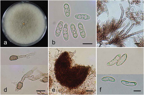 Fig. 2 (Colour online) Morphological characteristics of Colletotrichum kahawae subsp. ciggaro isolated from avocado in South Korea. (a), Mycelium grown on PDA. (b), Conidia. (c), Setae. (d), Appresoria. (e), Perithecium. (f), Ascospores. Bar = 10 μm in B, C, D and F and bar = 50 μm in E