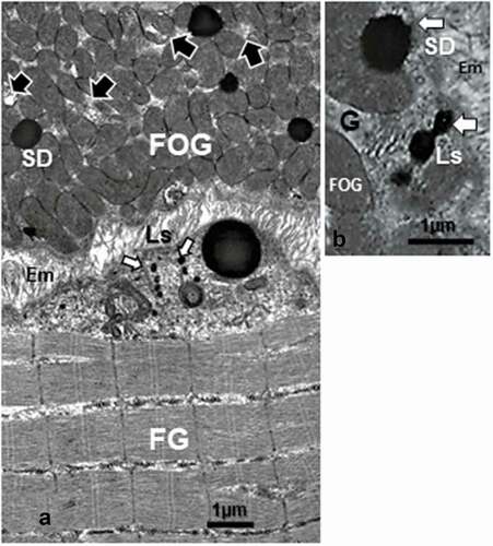 Figure 9. a-b: FOG and FG adjacent fibers of adult obese female Zucker rat tibialis anterior muscle. Note the FOG aggregate of mitochondria compared with the FG fiber (low part of 10A) devoid of such subsarcolemmal crowding but one SD showed closely adjacent to the sarcolemma. Both micrographs illustrate small aligned heavily contrasted strings of three vesicles in both fibers, marked by white arrows as Ls. A Golgi (g) zone could be involved with local endoplasm and process of capture and storage of these formed vesicles