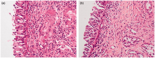 Figure 7. Histopathology of sheep nasal mucosa. (a) Nasal mucosa of untreated control (20×) and (b) nasal mucosa permeated with CPC-08 (20×).