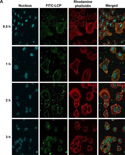 Figure 6 The CLSM images of A549 cells treated with FITC-LCP at various time periods (A) and at various concentrations (B). Magnification ×600.Abbreviations: CLSM, confocal laser scanning microscopy; FITC, fluorescein isothiocyanate; LCP, lipid-coated hollow calcium phosphate.